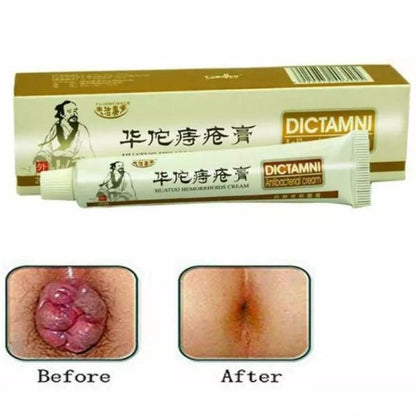 Chinese Herbal Hemorrhoids Cream