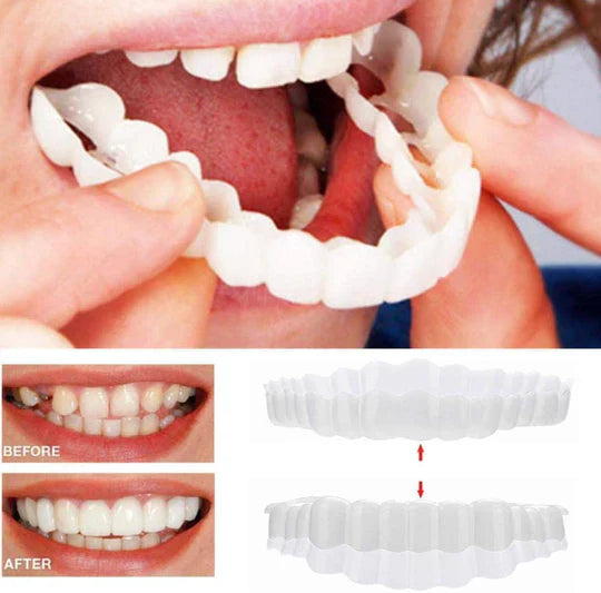Complete Teeth Veneer Kit Upper Lower Set