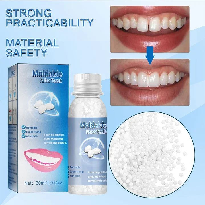 Moldable Dental Repair Kit with Heat Activated Polymer and Cold Water Setting