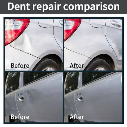 Easy DIY Car Dent Removal Tool Kit, Paintless Auto Body Repair Tools