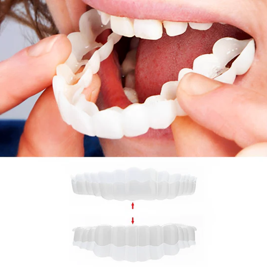 Complete Teeth Veneer Kit Upper Lower Set