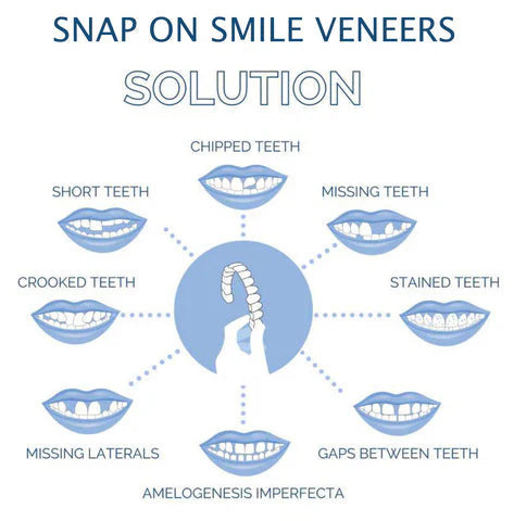 Complete Teeth Veneer Kit Upper Lower Set