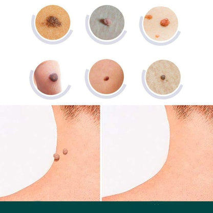 Skin Tag Remover Hydrocolloid Patches
