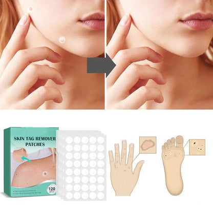 Skin Tag Remover Hydrocolloid Patches