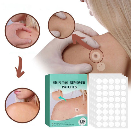 Skin Tag Remover Hydrocolloid Patches